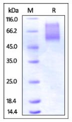 Human CX3CL1, His Tag on SDS-PAGE under reducing (R) condition. The gel was stained overnight with Coomassie Blue. The purity of the protein is greater than 95%.